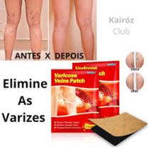 Emplastos para tratar varizes