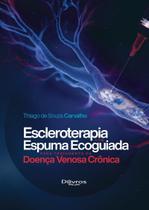 Escleroterapia Com Espuma Ecoguiada Para Tratamento Da Doença Venosa Crônica