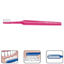 Escova dental para implante e aparelho - TEPE