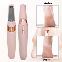 Esfoliador Elétrico Ergonômico: USB 3-4h, Cabeça Rolante Limpa Fácil, Casa/Salões, Calos/Seca Esfoliador Elétrico Ergonômico: USB 3-4h, Cabeça Rolante Limpa Fácil, Casa/Salões, Calos/Seca