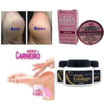 Esfoliante corporal e rosto pele uniformizada Creme hidratante -kit mulher 4 -itens