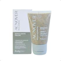 Esfoliante Facial Ruby Skin Acnover Pele Acneica 50g HB-400
