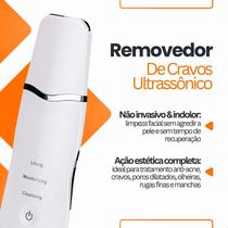 Espátula Facial Ultrassônica Skin Scrubber Peeling Limpeza de Pele Profunda Removedor Cravos Pro Espátula Facial Ultrassônica Skin Scrubber Peeling Limpeza de Pele Profunda Removedor Cravos Pro