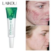 Especialista em Rosto: Gel de Babosa Laikou 20g Natural