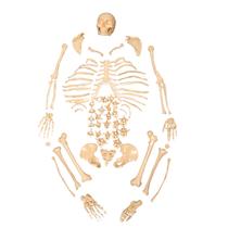 Esqueleto Humano Padrão Desarticulado
