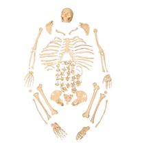 Esqueleto Humano Padrão Tamanho Natural Desarticulado - ANATOMIC
