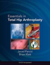 Essentials in total hip arthroplasty - SLACK INCORPORATED