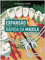 Expansao rapida da maxila: uso clinico em adulto - ED NAPOLEAO