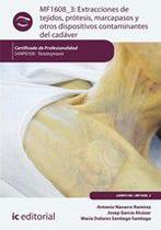 Extracciones de tejidos, prótesis, marcapasos y otros dispositivos contaminantes del cadáver. SANP0108 - Tanatopraxia