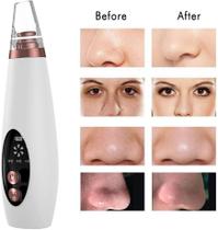 Extrator de Cravos Aparelho Removedor a Vácuo Recarregável 6 CABEÇAS USB Extrator de Cravos Aparelho Removedor a Vácuo Recarregável 6 CABEÇAS USB