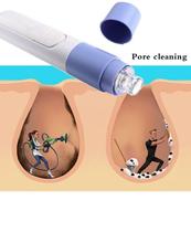 Extrator de Cravos Vácuo Profissional Sucção Facial Limpeza de Pele Portátil Skincare Completo Top Extrator de Cravos Vácuo Profissional Sucção Facial Limpeza de Pele Portátil Skincare Completo Top