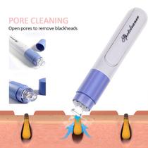 Extrator de Cravos Vácuo Profissional Sucção Facial Limpeza de Pele Portátil Skincare Top Bivolt Extrator de Cravos Vácuo Profissional Sucção Facial Limpeza de Pele Portátil Skincare Top Bivolt