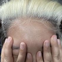 Fecho BEEOS 5x5 Skinlike Real HD Lace 613 Blonde 50cm Fecho BEEOS 5x5 Skinlike Real HD Lace 613 Blonde 50cm