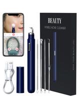 Ferramentas visuais de remoção de cravos com câmera, kit de ferramentas extrator de espinhas com câmera 20X 1080P, limpador de poros, kit extrator de acne Comedone Whitehead para iPhone/Android (azul)