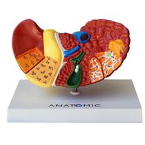 Fígado Humano Com Patologia - Anatomic
