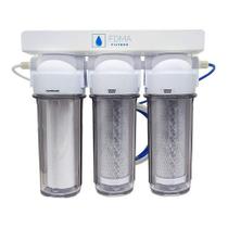 Filtro 3 Estágios para Consumo Transparente Filtro 3 Estágios para Consumo Transparente