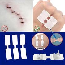 Fita Adesiva para Ferimentos - Kit com 5 Patches Descartáveis para Primeiros Socorros