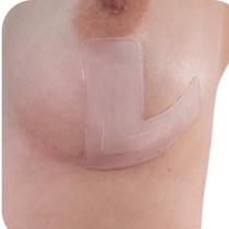 Fita Silicone Cicatriz Queloide Mama Formato L - SiliSkin