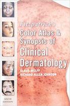 Fitzpatrick color atlas synopsis of clinical dermatology - MCGRAW