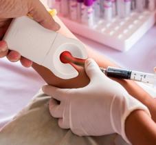 Fleboscópio Acha Veia Ipauher OrthoPauher