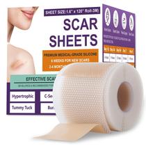 Folhas de cicatrizes de silicone Psecici para cicatrizes cirúrgicas 1,6x120cm Folhas de cicatrizes de silicone Psecici para cicatrizes cirúrgicas 1,6x120cm