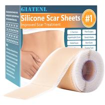 Folhas de silicone para cicatrizes GIATENL 4 cm x 150 cm Fita reutilizável
