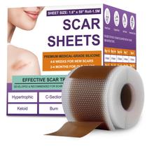 Folhas de Silicone para Cicatrizes PSECICI 4 cm 1,5 m Grau Médico Folhas de Silicone para Cicatrizes PSECICI 4 cm 1,5 m Grau Médico