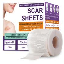 Folhas de Silicone para Cicatrizes PSECICI 4,1 cm x 3 m Grau Médico Folhas de Silicone para Cicatrizes PSECICI 4,1 cm x 3 m Grau Médico