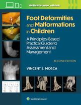 Foot deformities and malformations in children