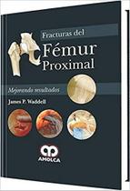 Fracturas del femur proximal (espanhol)
