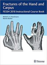 Fractures of the hand and carpus: fessh 2018 instructional course book - Thieme Publishers Inc/maple Press