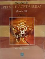 Fraturas da Pelve e do Acetabulo - REVINTER RJ