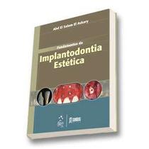 Fundamentos de implantodontia estetica
