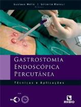 Gastrostomia Endoscópica Percutânea - Técnicas e Aplicações De: R$ 348,00 - Gastrostomia Endoscópica Percutânea - Técnicas e Aplicações De: R$ 348,00 -