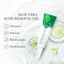 Gel de Aloe Vera Barato para Rosto com Resultados Reais Gel de Aloe Vera Barato para Rosto com Resultados Reais