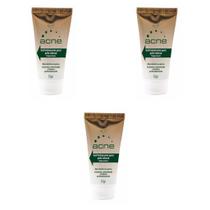 Gel Hidratante Acne 3 Unidades Gel Hidratante Acne 3 Unidades