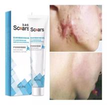 Gel Scoars 20g Para Cicatrizes E Queloides