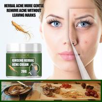 Ginseng Herbal Acne Cream Desalt Acne Scar Acne Repair Acne Cream