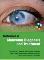 Glaucoma diagnosis and management with cd