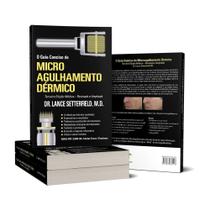 Guia conciso-microagulhamento -