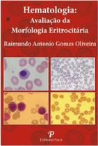 Hematologia. Avaliação da Morfologia Eritrocitária (Pranchas)