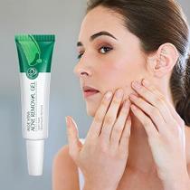 Hidratante Facial de Babosa para Pele com Brilho e Cravos Hidratante Facial de Babosa para Pele com Brilho e Cravos