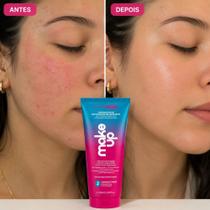 Hidratante Primer Anticraquelamento Dermachem Pré Maquiagem Facial Hidratante Primer Anticraquelamento Dermachem Pré Maquiagem Facial