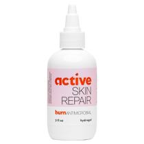 Hidrogel de primeiros socorros para cicatrização de queimaduras e reparo ativo da pele 90 ml