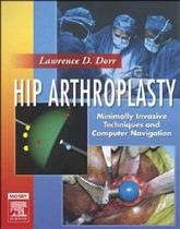 Hip arthroplasty: minimally invasive techniques and computer navigation, te