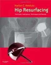 Hip resurfacing principles indications technique