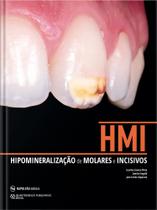 Hipomineralização de Molares e Incisivos - Editora Napoleão