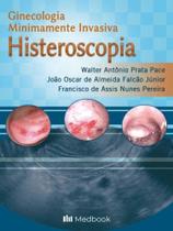Histeroscopia - Ginecologia Minimamente Invasiva - MEDBOOK EDITORA