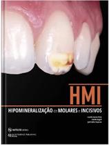 Hmi: hipomineralizacao de molares e incisivos - Ed Napoleao Hmi: hipomineralizacao de molares e incisivos - Ed Napoleao