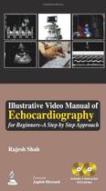 Illustrative video manual of echocardiography for beginners a step by step